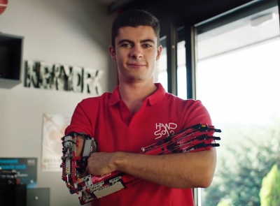 David Agilara: Od Lego kocki napravio protetičku ruku
